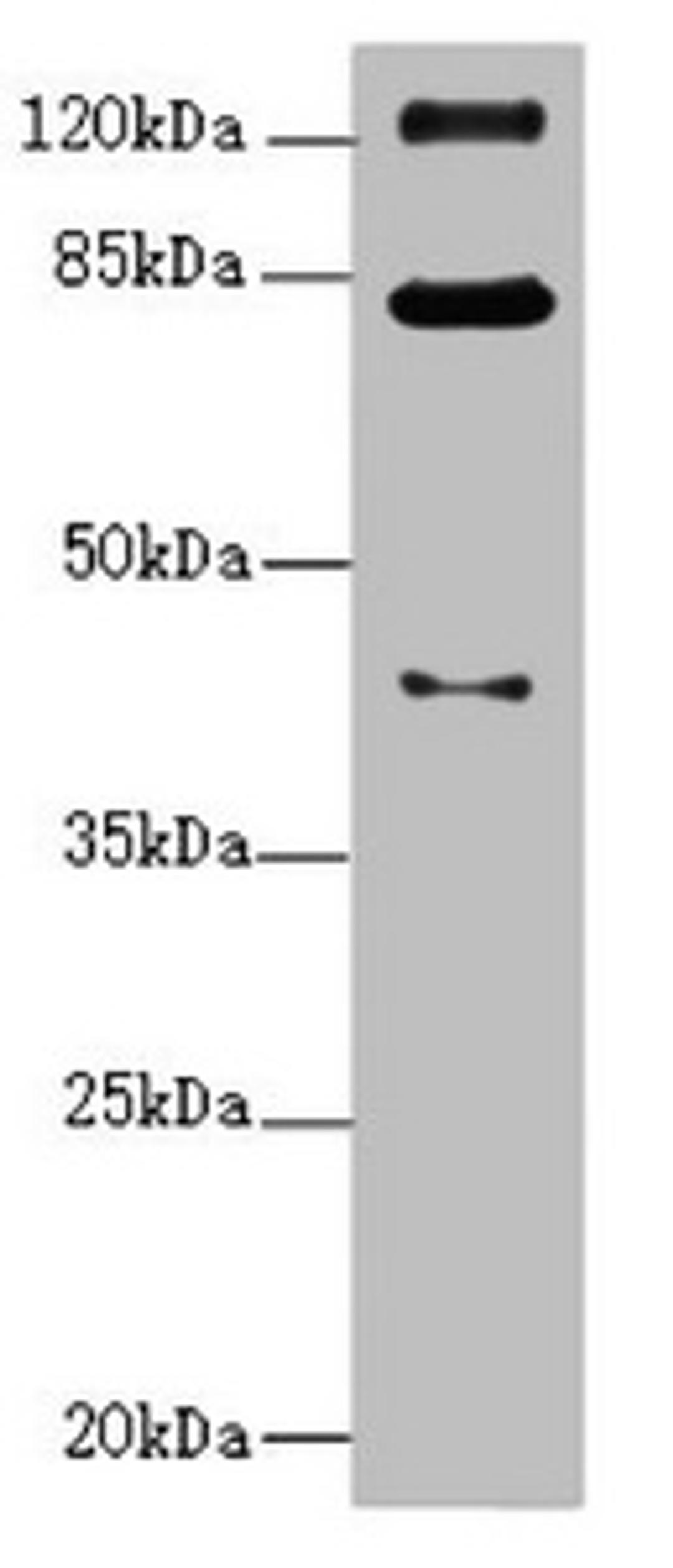 Western blot. All lanes: PEX3 antibody at 1.11ug/ml + Mouse kidney tissue. Secondary. Goat polyclonal to rabbit IgG at 1/10000 dilution. Predicted band size: 42 kDa. Observed band size: 42, 82, 125 kDa. 