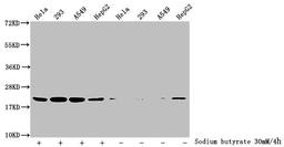 Western Blot. Detected samples: Hela whole cell lysate, 293 whole cell lysate, A549 whole cell lysate, HepG2 whole cell lysate; Untreated (-) or treated (+) with 30mM sodium butyrate for 4h. All lanes: HIST1H1C antibody at 3.5µg/ml. Secondary. Goat polyclonal to rabbit IgG at 1/50000 dilution. Predicted band size: 22 kDa. Observed band size: 22 kDa