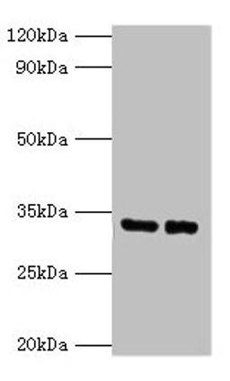 Western blot. All lanes: SRM antibody at 2µg/ml. Lane 1: EC109 whole cell lysate. Lane 2: 293T whole cell lysate. Secondary. Goat polyclonal to rabbit IgG at 1/15000 dilution. Predicted band size: 34 kDa. Observed band size: 34 kDa