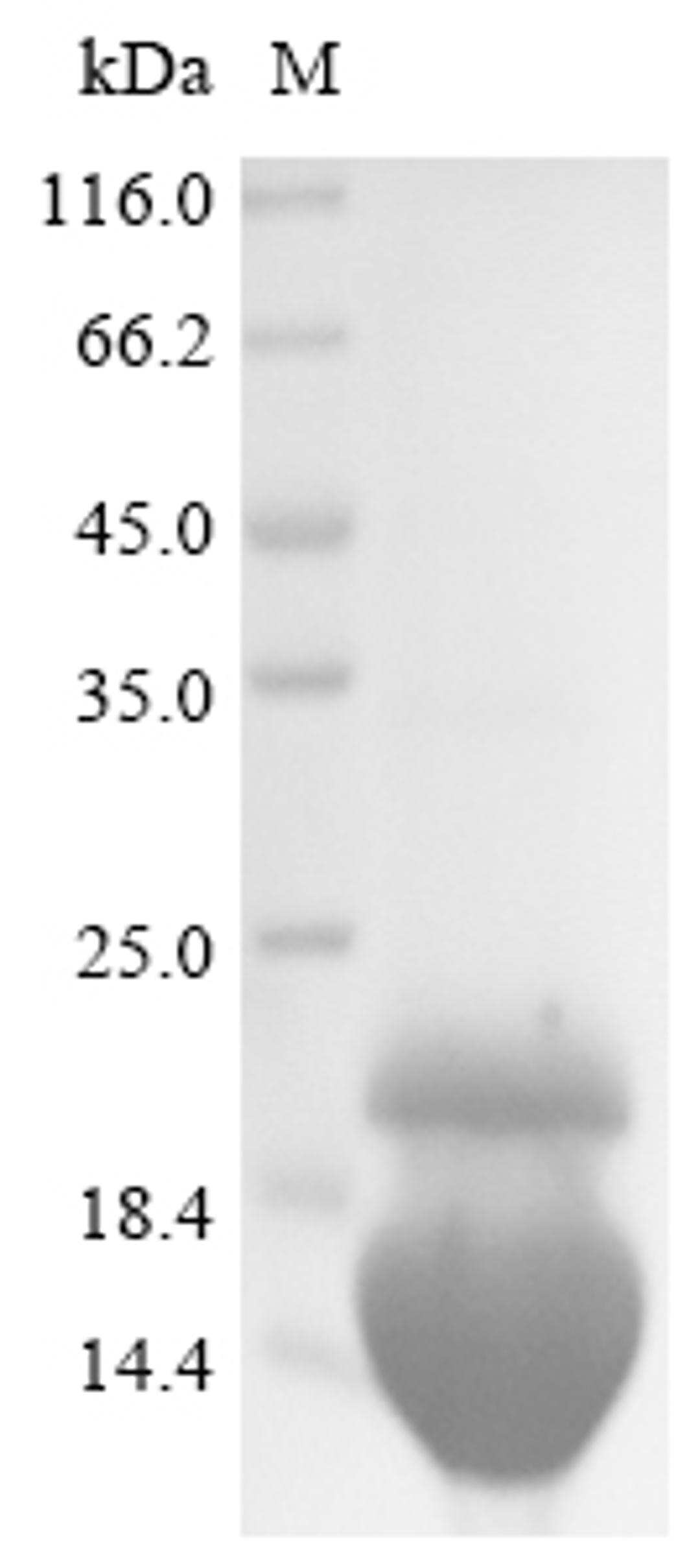 (Tris-Glycine gel) Discontinuous SDS-PAGE (reduced) with 5% enrichment gel and 15% separation gel.