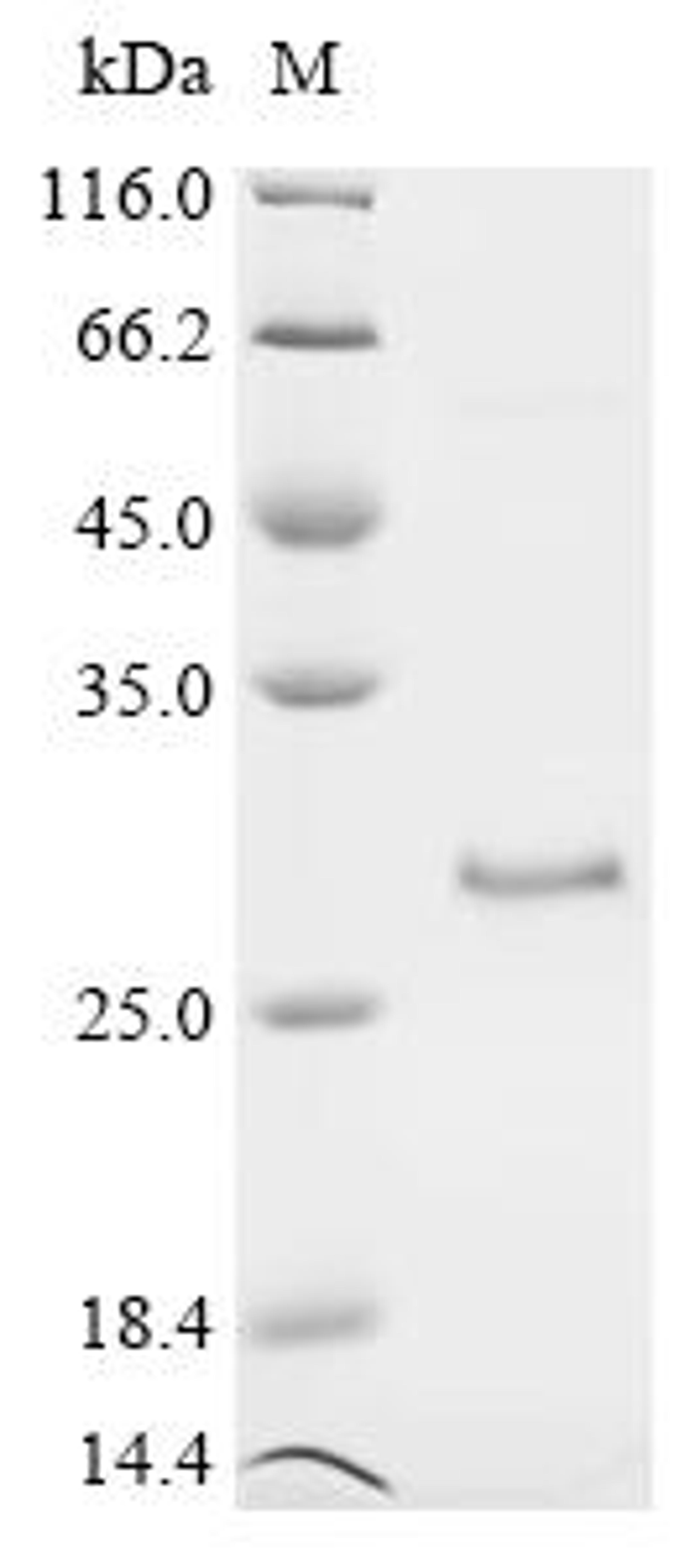 (Tris-Glycine gel) Discontinuous SDS-PAGE (reduced) with 5% enrichment gel and 15% separation gel.