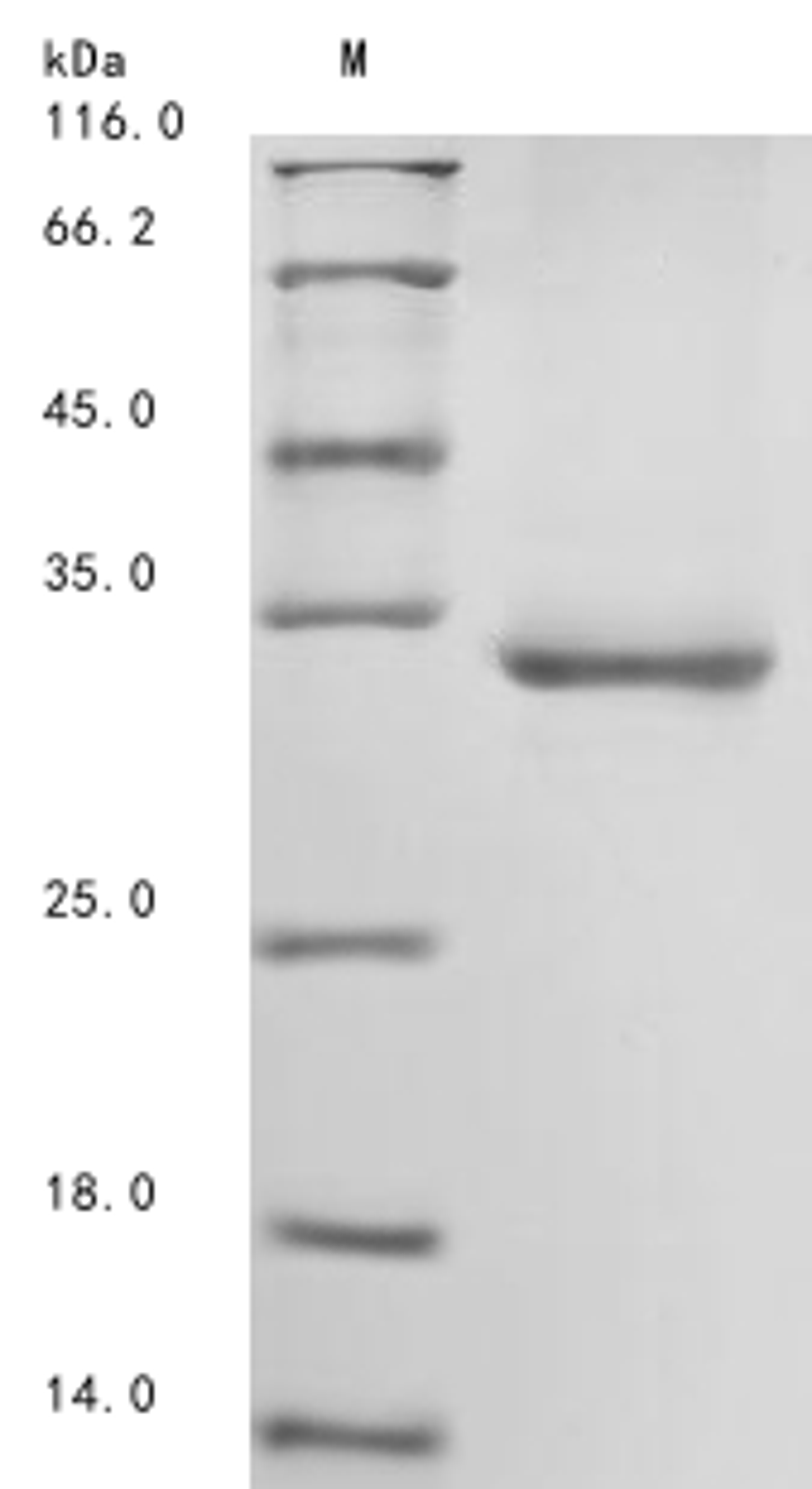 (Tris-Glycine gel) Discontinuous SDS-PAGE (reduced) with 5% enrichment gel and 15% separation gel.