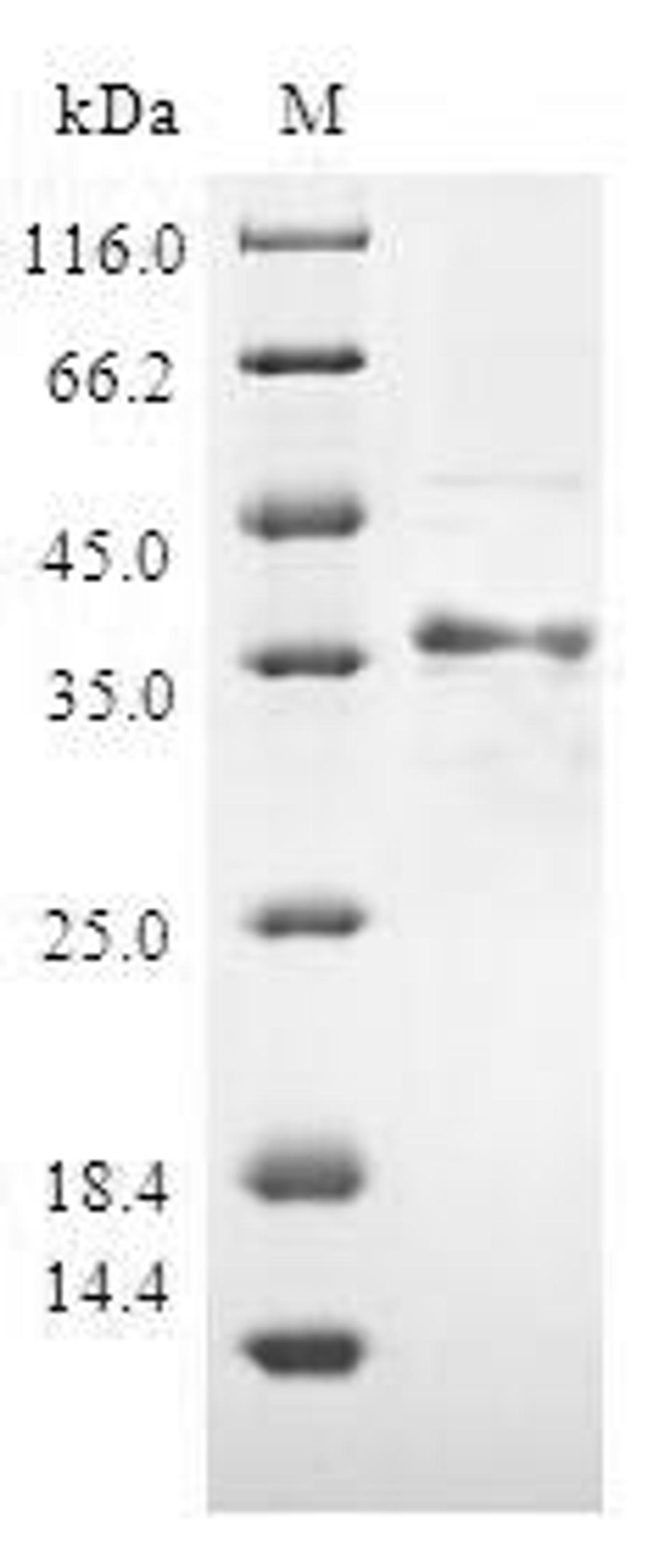 (Tris-Glycine gel) Discontinuous SDS-PAGE (reduced) with 5% enrichment gel and 15% separation gel.