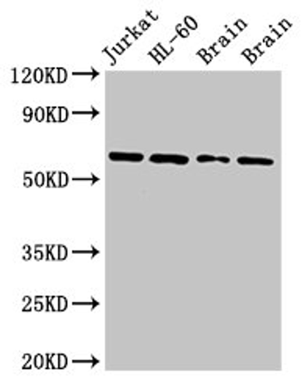 Western Blot. Positive WB detected in: Jurkat whole cell lysate, HL60 whole cell lysate, Rat brain tissue, Mouse brain tissue. All lanes: ARX antibody at 2.7ug/ml. Secondary. Goat polyclonal to rabbit IgG at 1/50000 dilution. Predicted band size: 59 kDa. Observed band size: 59 kDa. 