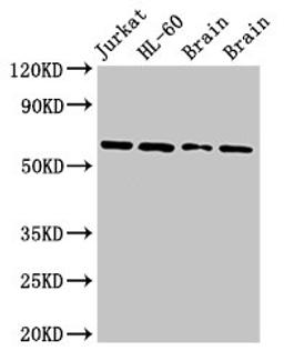 Western Blot. Positive WB detected in: Jurkat whole cell lysate, HL60 whole cell lysate, Rat brain tissue, Mouse brain tissue. All lanes: ARX antibody at 2.7ug/ml. Secondary. Goat polyclonal to rabbit IgG at 1/50000 dilution. Predicted band size: 59 kDa. Observed band size: 59 kDa. 