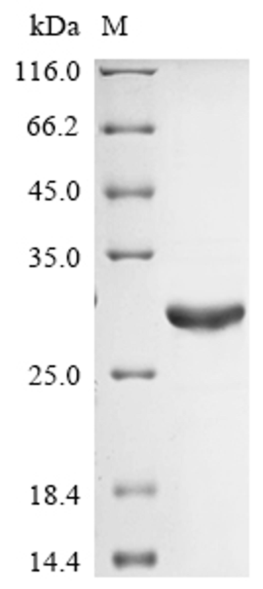 (Tris-Glycine gel) Discontinuous SDS-PAGE (reduced) with 5% enrichment gel and 15% separation gel.