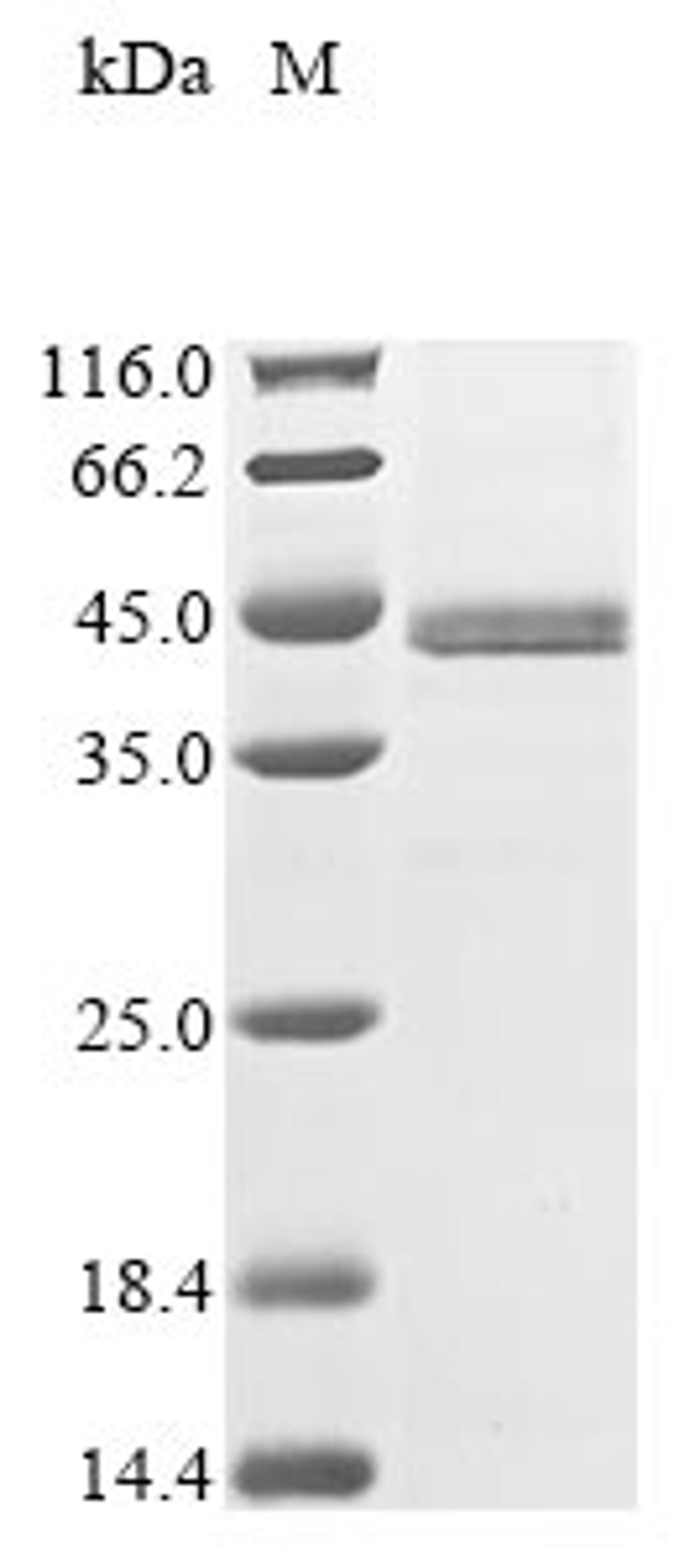 (Tris-Glycine gel) Discontinuous SDS-PAGE (reduced) with 5% enrichment gel and 15% separation gel.