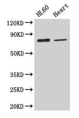 Western Blot. Positive WB detected in: HL60 whole cell lysate, Mouse heart tissue. All lanes: CAST antibody at 2.6µg/ml. Secondary. Goat polyclonal to rabbit IgG at 1/50000 dilution. Predicted band size: 77, 76, 64, 72, 82, 85, 83, 75, 81 kDa. Observed band size: 77 kDa