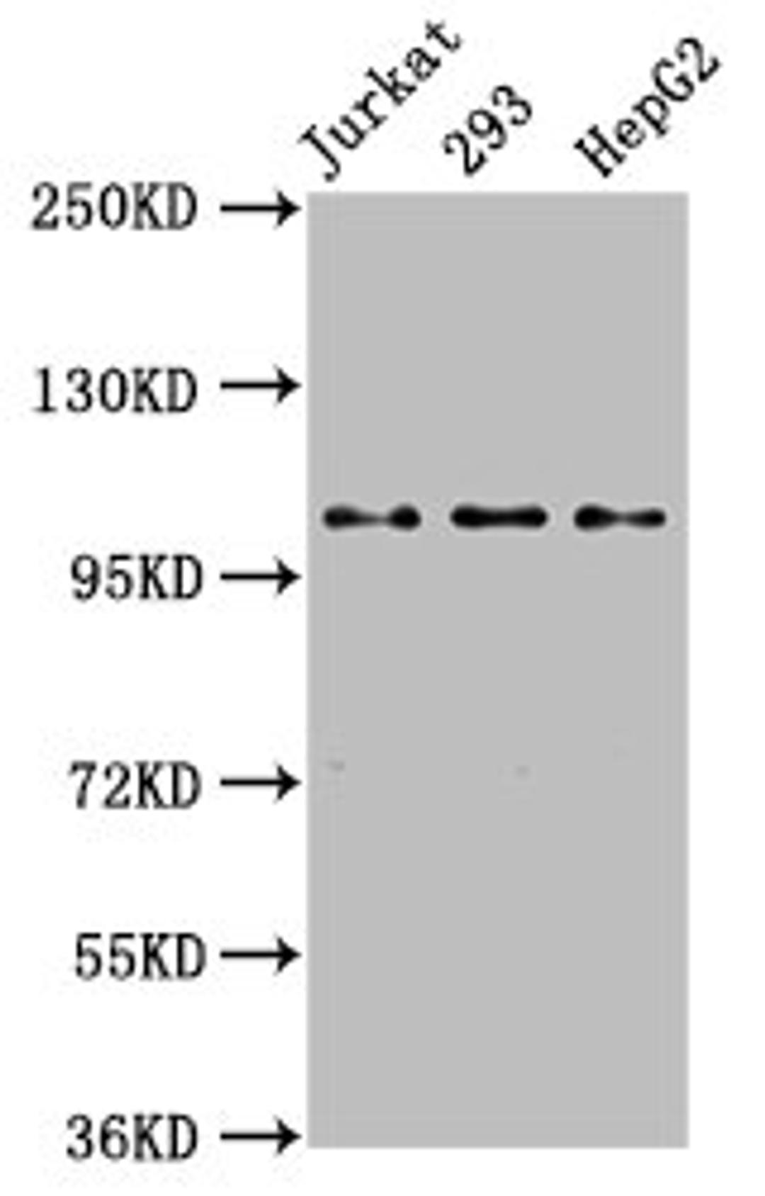 Western Blot. Positive WB detected in: Jurkat whole cell lysate, 293 whole cell lysate, HepG2 whole cell lysate. All lanes: KIF5B antibody at 3.2µg/ml. Secondary. Goat polyclonal to rabbit IgG at 1/50000 dilution. Predicted band size: 110 kDa. Observed band size: 110 kDa