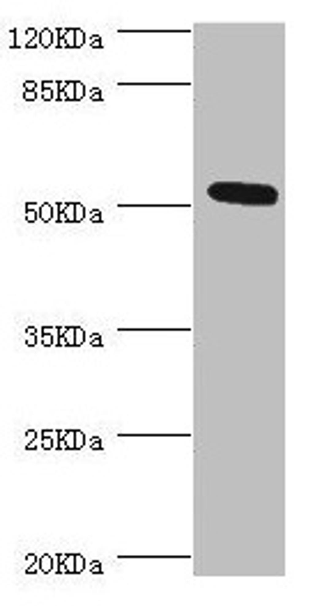 Western blot. All lanes: ZC3HC1 antibody at 0.98µg/ml + Hela whole cell lysate. Secondary. Goat polyclonal to rabbit IgG at 1/10000 dilution. Predicted band size: 56, 54, 48 kDa. Observed band size: 54 kDa