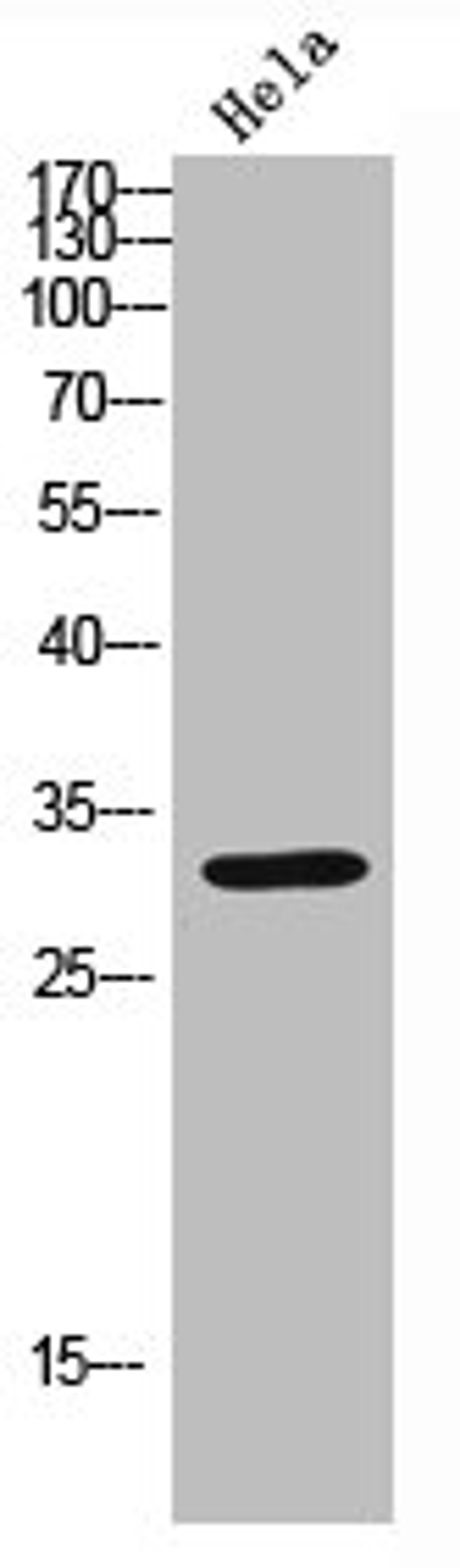 Western blot analysis of Hela lysate, antibody was diluted at 2000. Secondary antibody  was diluted at 1:20000