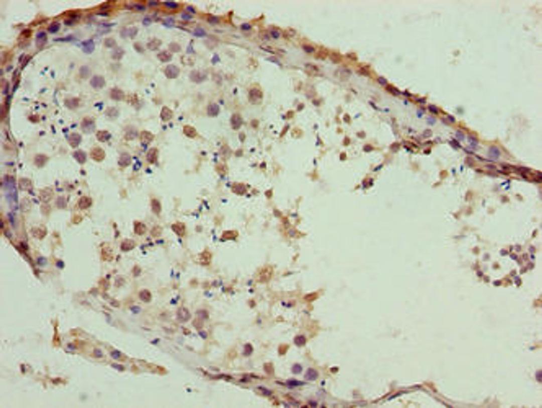 Immunohistochemistry of paraffin-embedded human testis tissue using CSB-PA853496LA01HU at dilution of 1:100