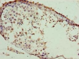 Immunohistochemistry of paraffin-embedded human testis tissue using CSB-PA853496LA01HU at dilution of 1:100