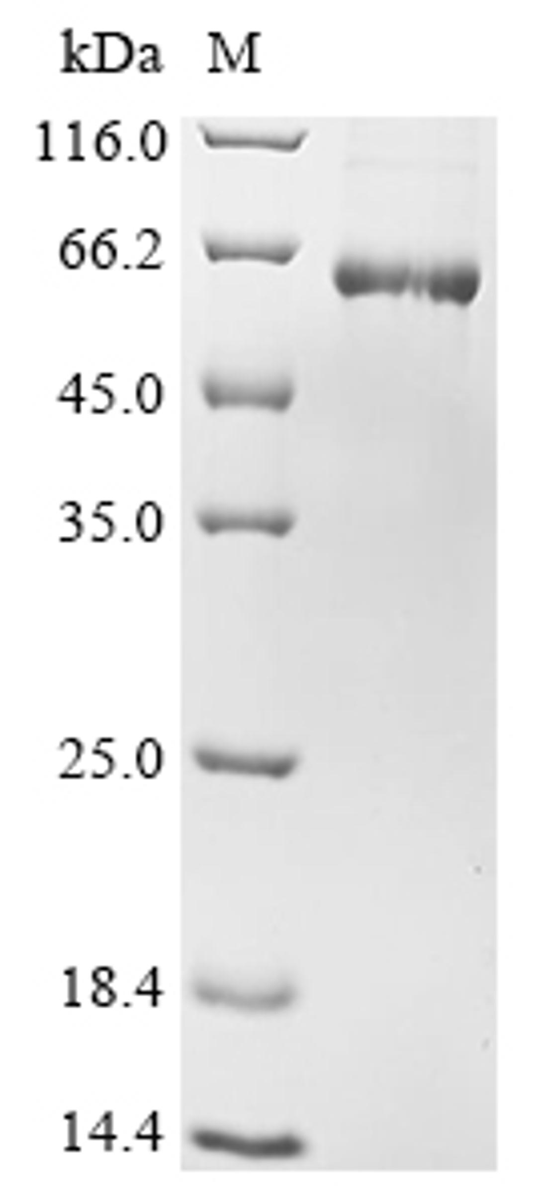 (Tris-Glycine gel) Discontinuous SDS-PAGE (reduced) with 5% enrichment gel and 15% separation gel.