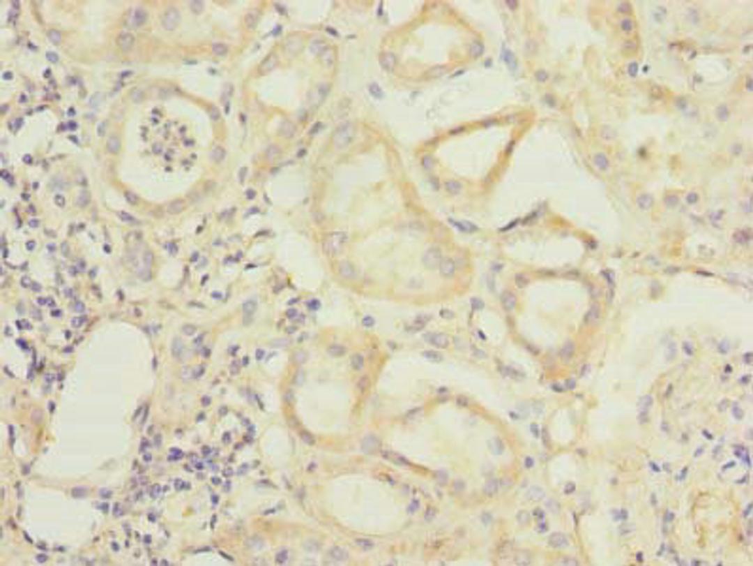Immunohistochemistry of paraffin-embedded human kidney tissue using CSB-PA04569A0Rb at dilution of 1:100