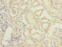 Immunohistochemistry of paraffin-embedded human kidney tissue using CSB-PA04569A0Rb at dilution of 1:100