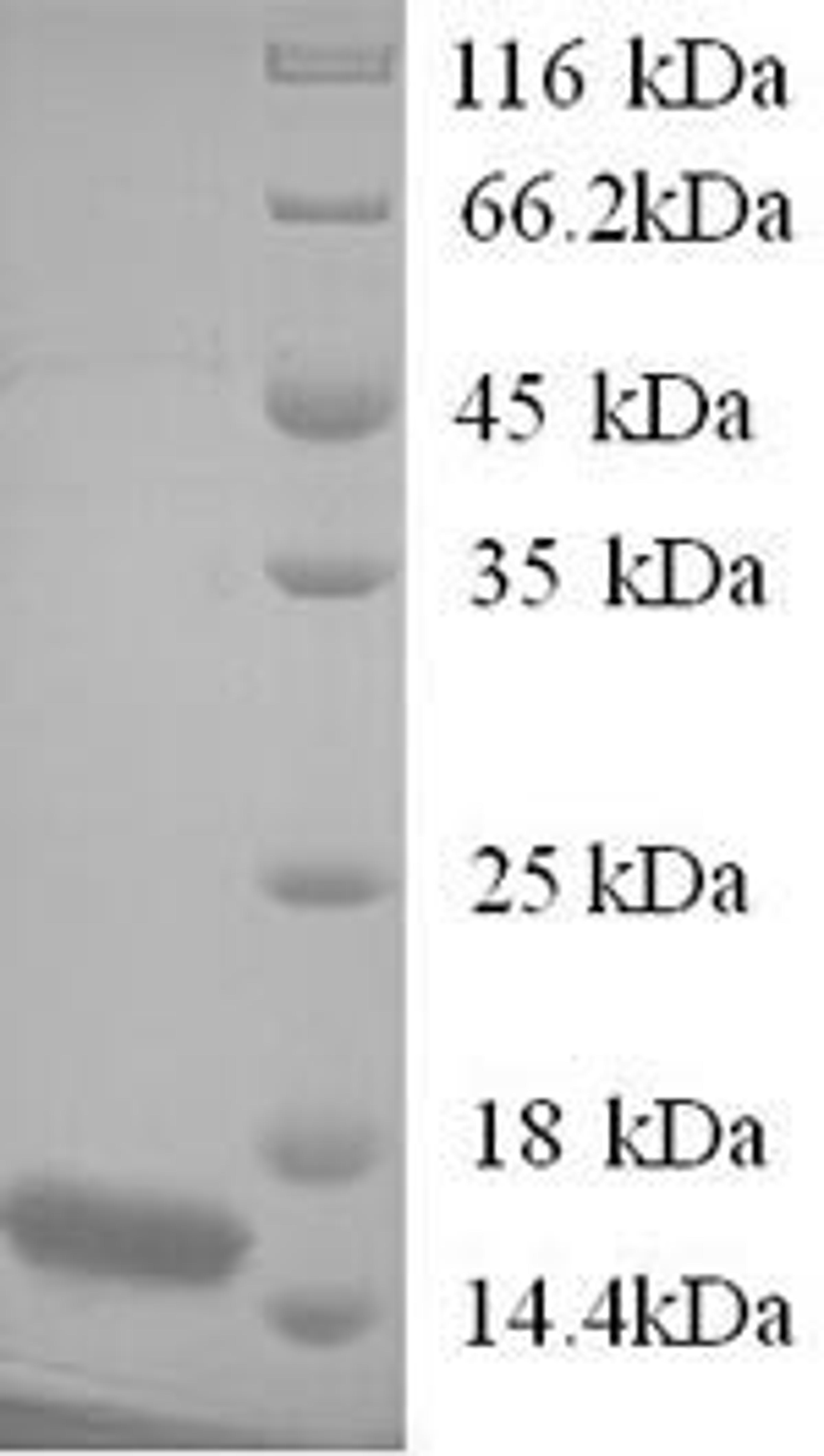 (Tris-Glycine gel) Discontinuous SDS-PAGE (reduced) with 5% enrichment gel and 15% separation gel.