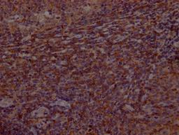 IHC image of CSB-RA553167A0HU diluted at 1:100 and staining in paraffin-embedded human tonsil tissue performed on a Leica BondTM system. After dewaxing and hydration, antigen retrieval was mediated by high pressure in a citrate buffer (pH 6.0). Section was blocked with 10% normal goat serum 30min at RT. Then primary antibody (1% BSA) was incubated at 4℃ overnight. The primary is detected by a Goat anti-rabbit IgG polymer labeled by HRP and visualized using 0.05% DAB.