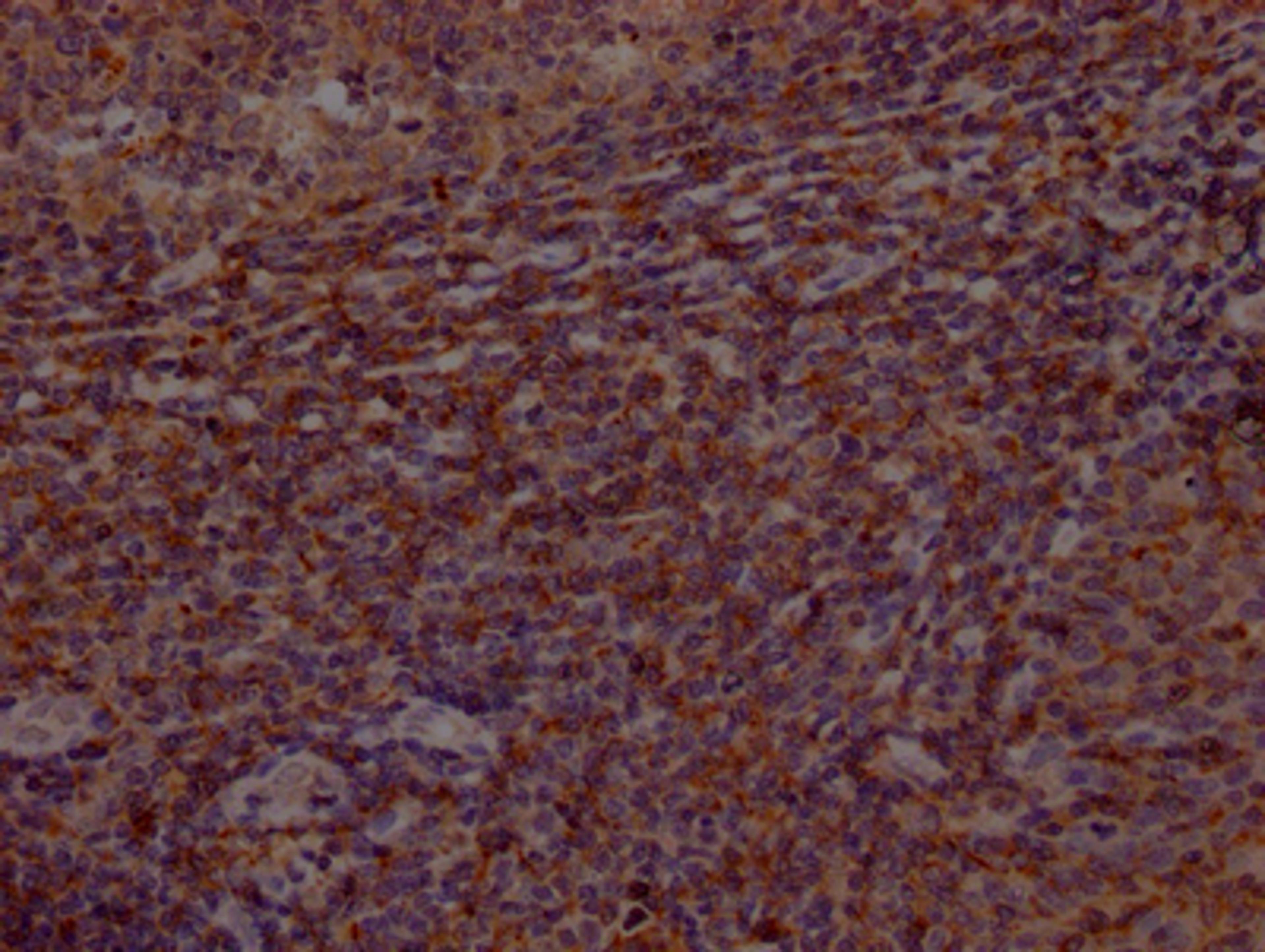 IHC image of CSB-RA553167A0HU diluted at 1:100 and staining in paraffin-embedded human tonsil tissue performed on a Leica BondTM system. After dewaxing and hydration, antigen retrieval was mediated by high pressure in a citrate buffer (pH 6.0). Section was blocked with 10% normal goat serum 30min at RT. Then primary antibody (1% BSA) was incubated at 4℃ overnight. The primary is detected by a Goat anti-rabbit IgG polymer labeled by HRP and visualized using 0.05% DAB.