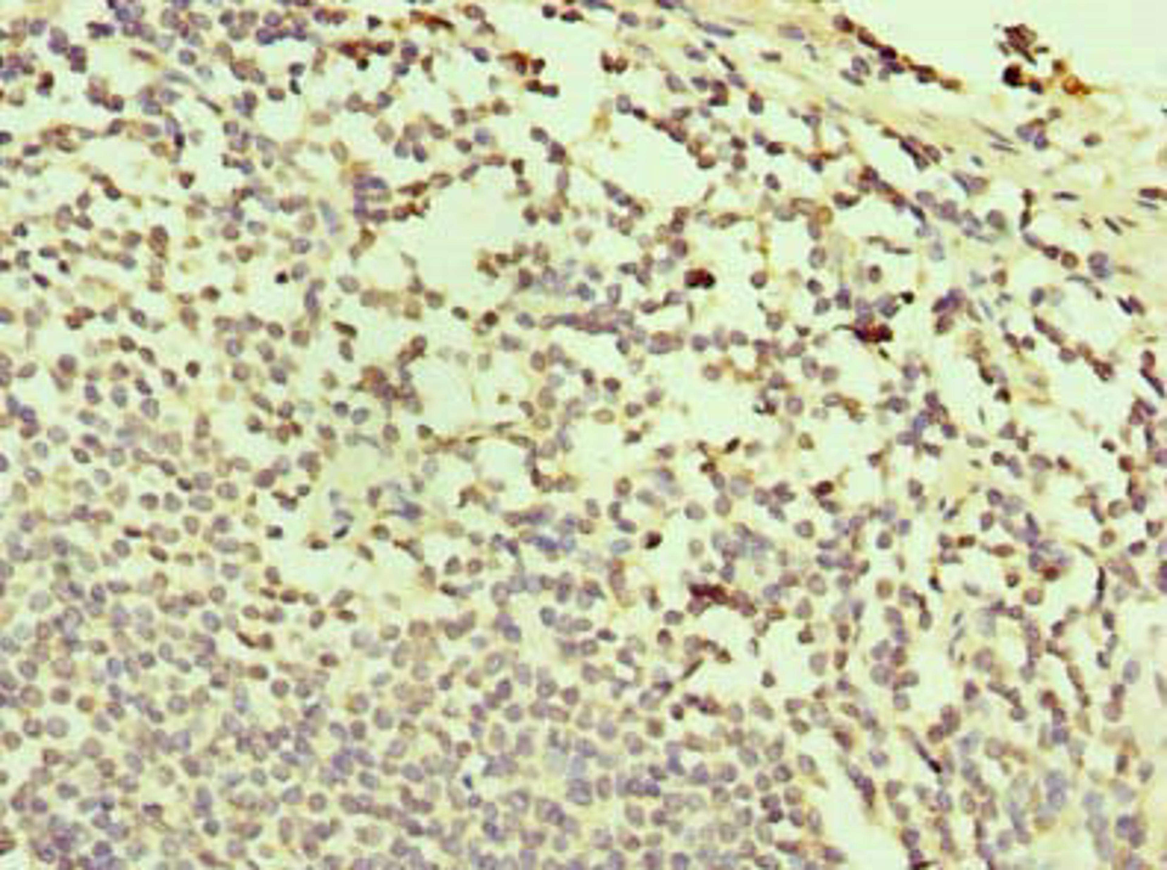 Immunohistochemistry of paraffin-embedded human small intestine tissue using CSB-PA761361LA01HU at dilution of 1:100