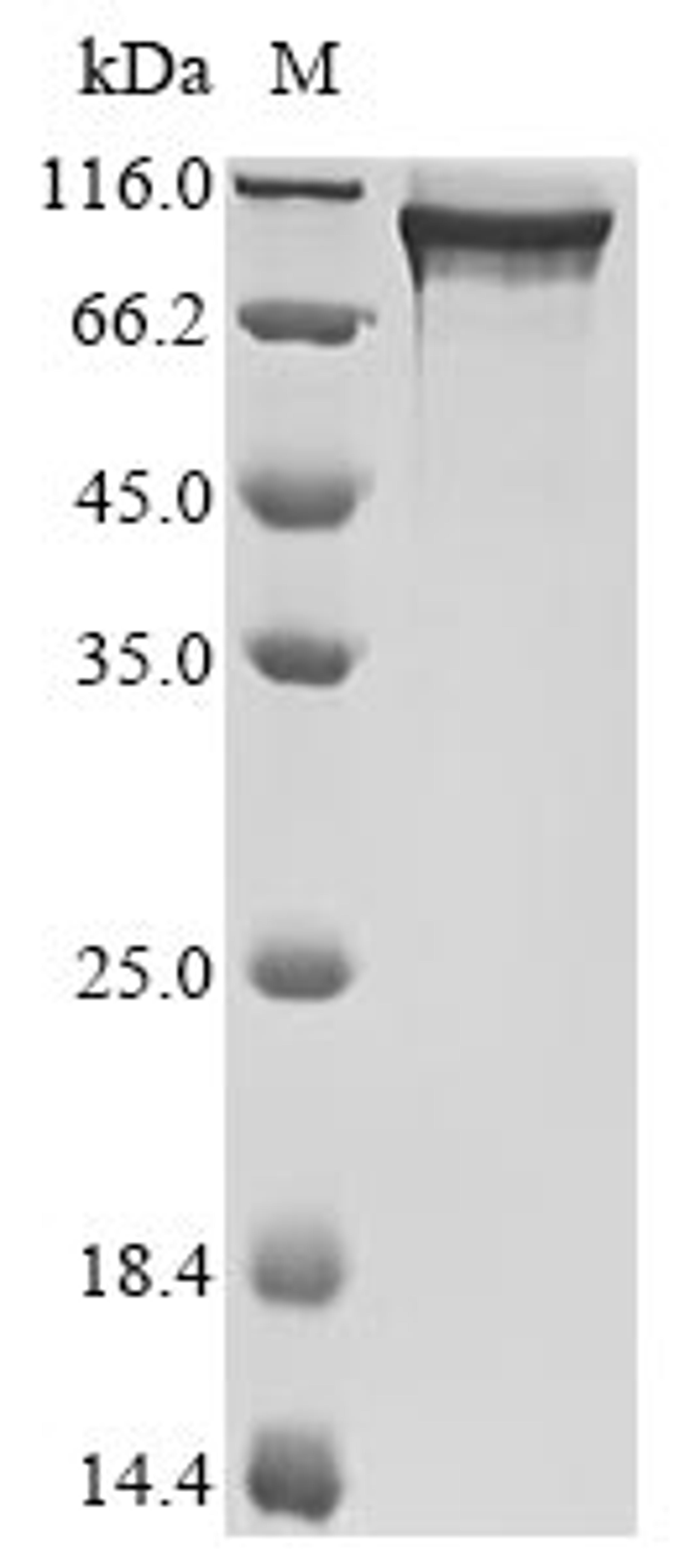 (Tris-Glycine gel) Discontinuous SDS-PAGE (reduced) with 5% enrichment gel and 15% separation gel.
