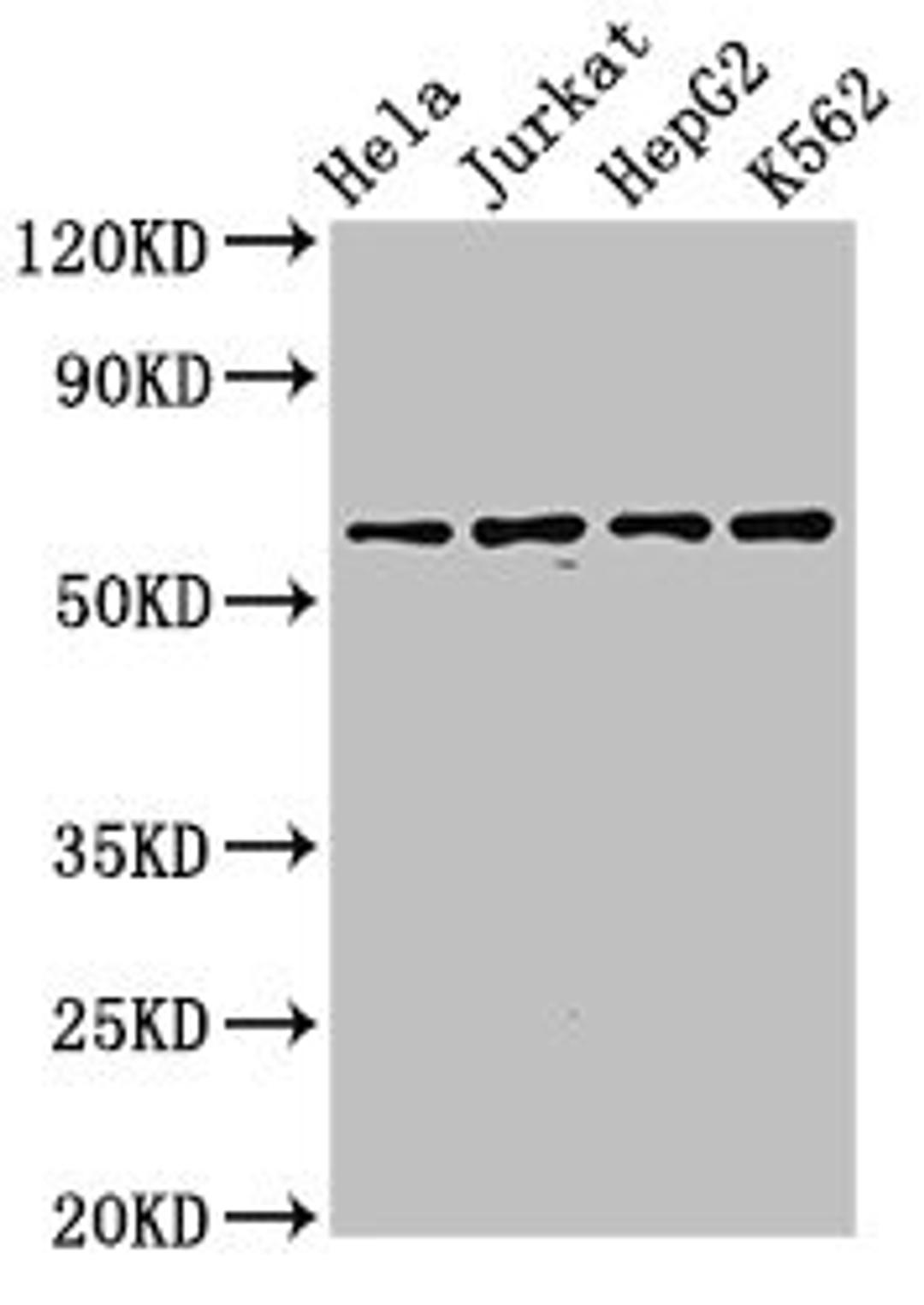 Western Blot. Positive WB detected in: Hela whole cell lysate, Jurkat whole cell lysate, HepG2 whole cell lysate, K562 whole cell lysate. All lanes: SMARCD1 antibody at 3.2µg/ml. Secondary. Goat polyclonal to rabbit IgG at 1/50000 dilution. Predicted band size: 59, 54 kDa. Observed band size: 59 kDa