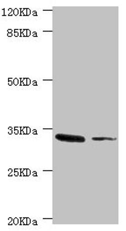 Western blot. All lanes: MGLL antibody at 2.37ug/ml. Lane 1: Mouse liver tissue. Lane 2: HT-29 whole cell lysate. Secondary. Goat polyclonal to rabbit IgG at 1/10000 dilution. Predicted band size: 34, 32 kDa. Observed band size: 34 kDa. 