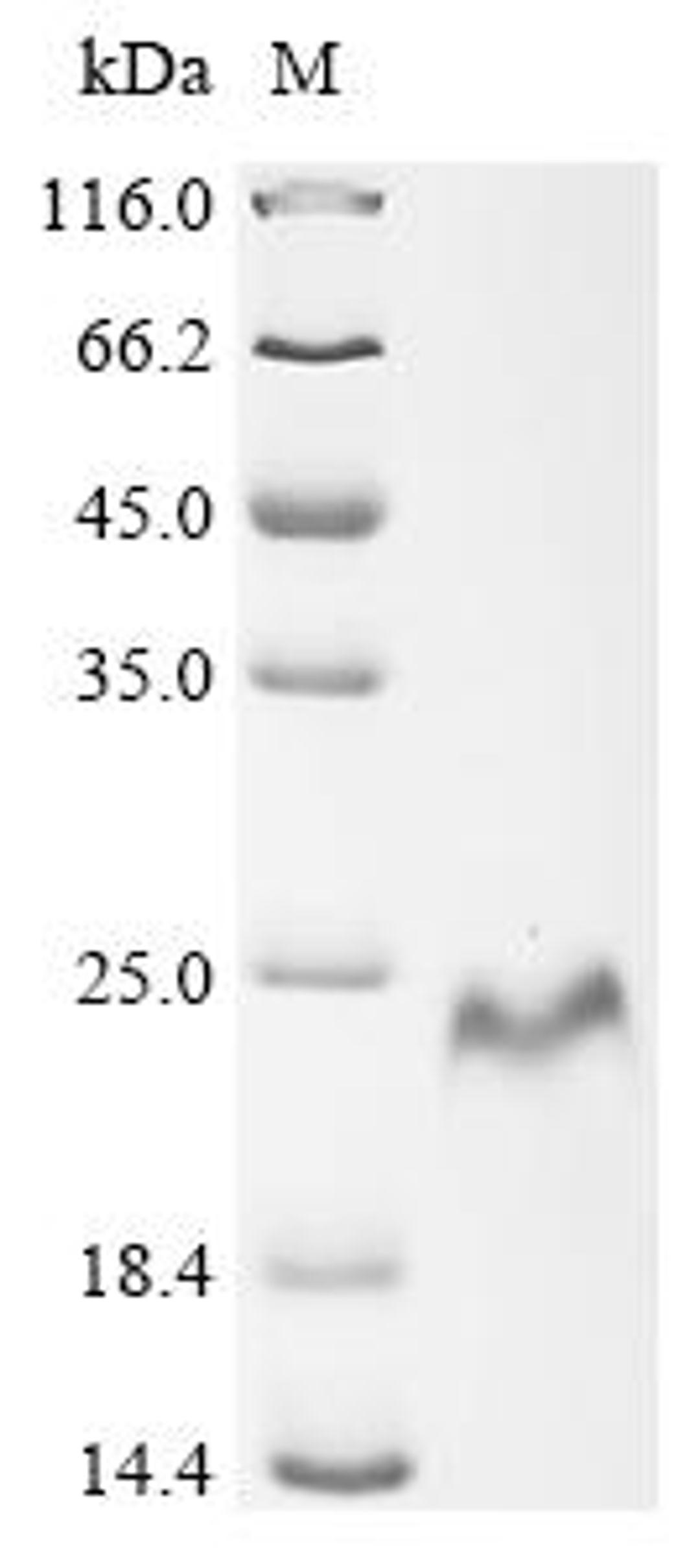 (Tris-Glycine gel) Discontinuous SDS-PAGE (reduced) with 5% enrichment gel and 15% separation gel.