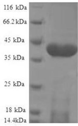 (Tris-Glycine gel) Discontinuous SDS-PAGE (reduced) with 5% enrichment gel and 15% separation gel.