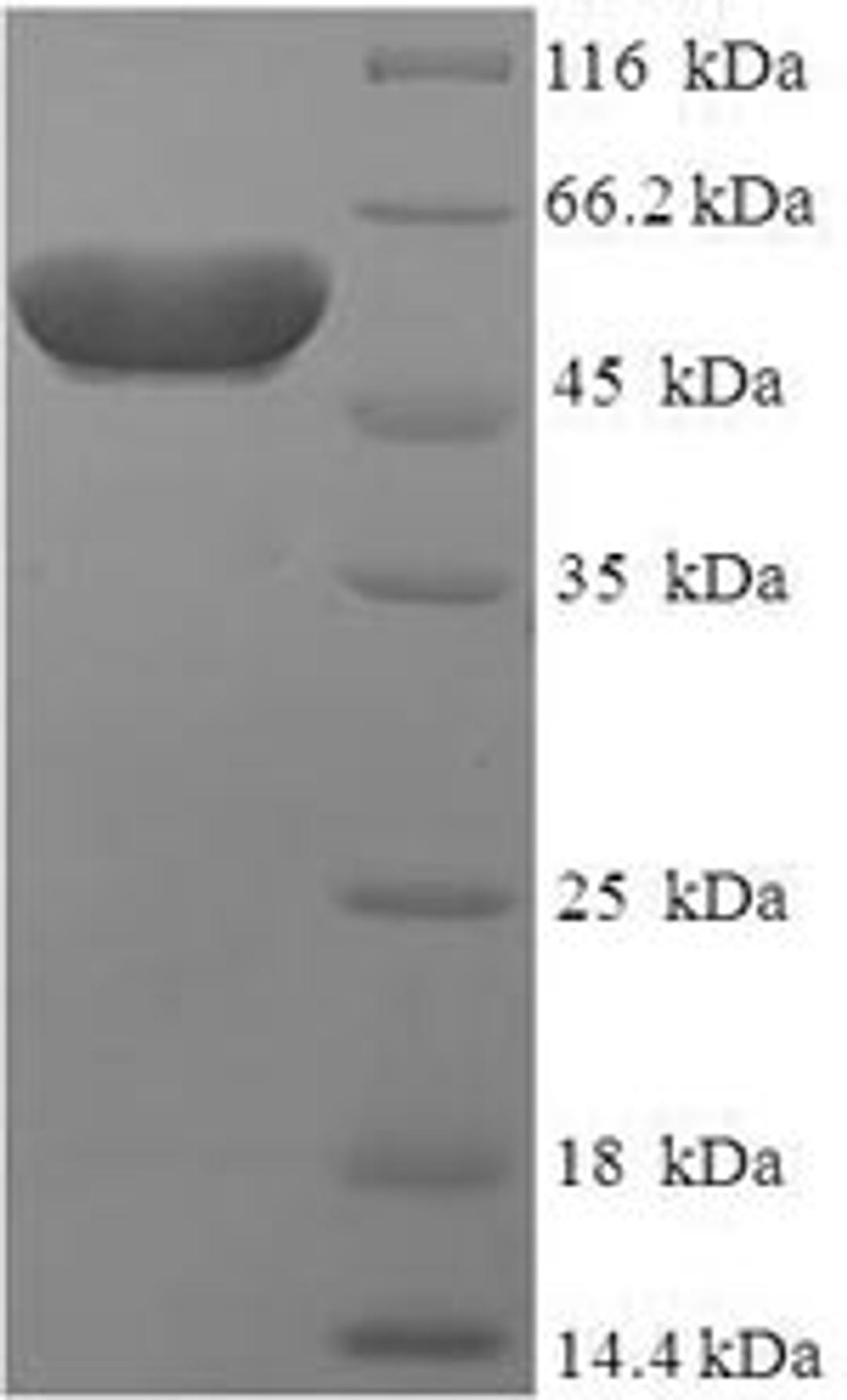(Tris-Glycine gel) Discontinuous SDS-PAGE (reduced) with 5% enrichment gel and 15% separation gel.