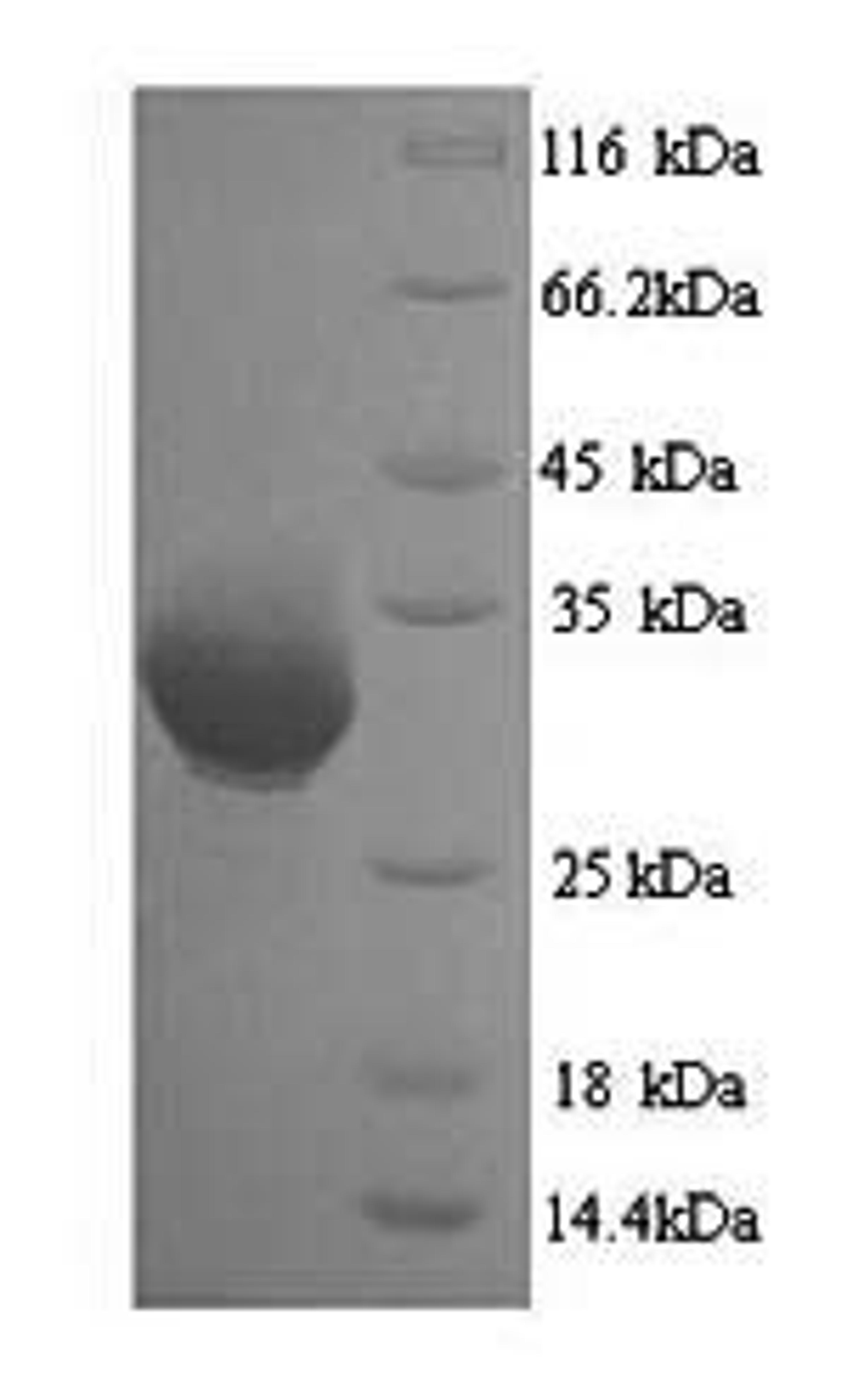 (Tris-Glycine gel) Discontinuous SDS-PAGE (reduced) with 5% enrichment gel and 15% separation gel.