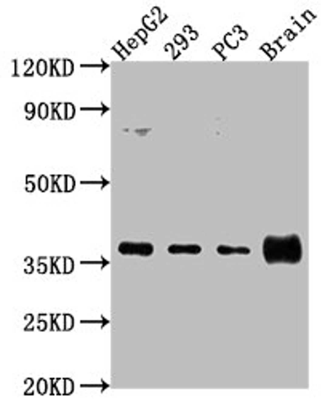 Western Blot. Positive WB detected in: HepG2 whole cell lysate, 293 whole cell lysate, PC3 whole cell lysate, Rat brain tissue. All lanes: RFNG antibody at 1:2000. Secondary. Goat polyclonal to rabbit IgG at 1/50000 dilution. Predicted band size: 37 kDa. Observed band size: 37 kDa. 