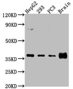 Western Blot. Positive WB detected in: HepG2 whole cell lysate, 293 whole cell lysate, PC3 whole cell lysate, Rat brain tissue. All lanes: RFNG antibody at 1:2000. Secondary. Goat polyclonal to rabbit IgG at 1/50000 dilution. Predicted band size: 37 kDa. Observed band size: 37 kDa. 
