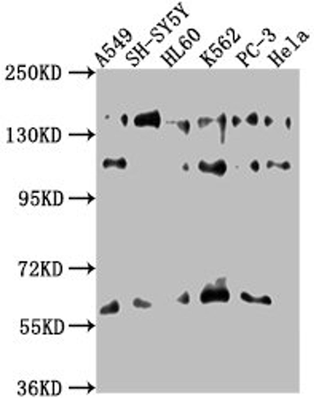 Western Blot. Positive WB detected in: A549 whole cell lysate, SH-SY5Y whole cell lysate, HL60 whole cell lysate, K562 whole cell lysate, PC-3 whole cell lysate, Hela whole cell lysate. All lanes: SOS2 antibody at 1:1000. Secondary. Goat polyclonal to rabbit IgG at 1/50000 dilution. Predicted band size: 153, 150 kDa. Observed band size: 153 kDa. 