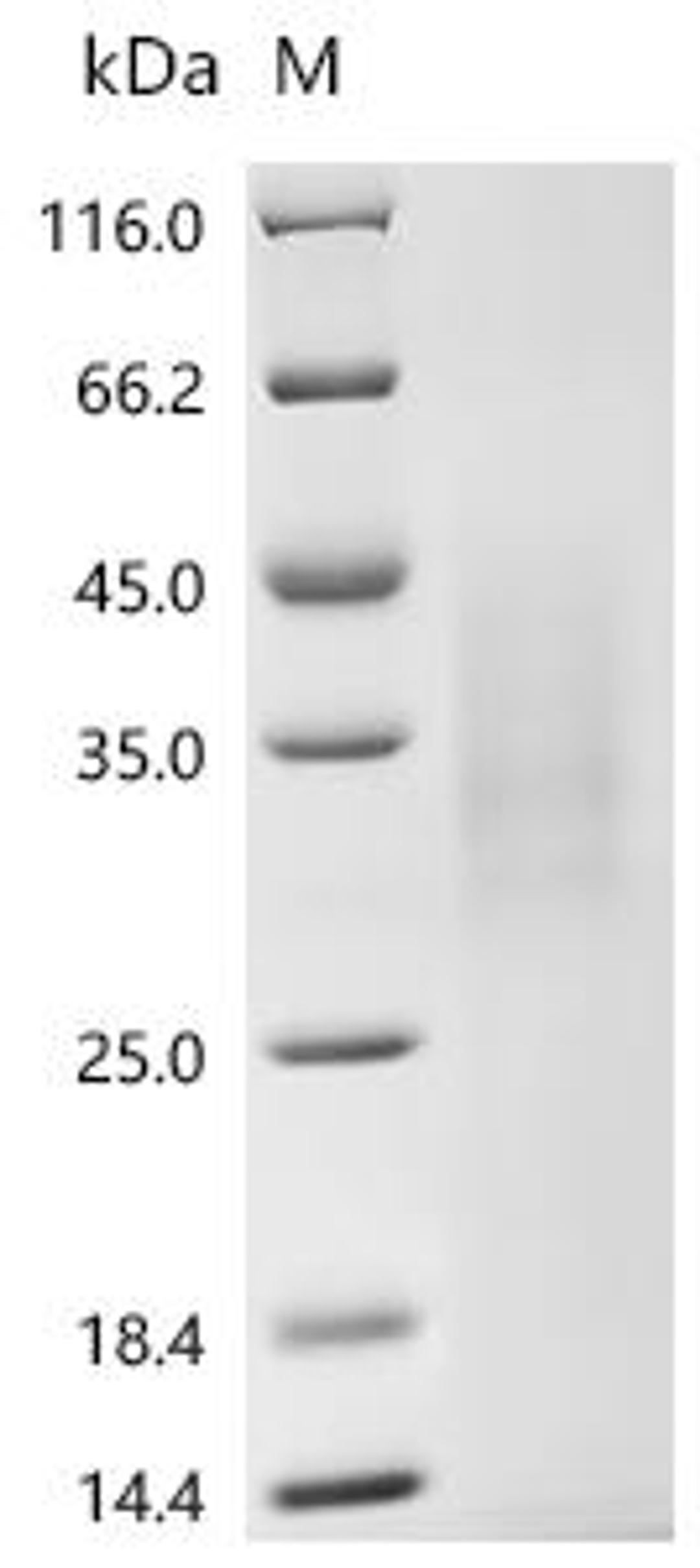 (Tris-Glycine gel) Discontinuous SDS-PAGE (reduced) with 5% enrichment gel and 15% separation gel.