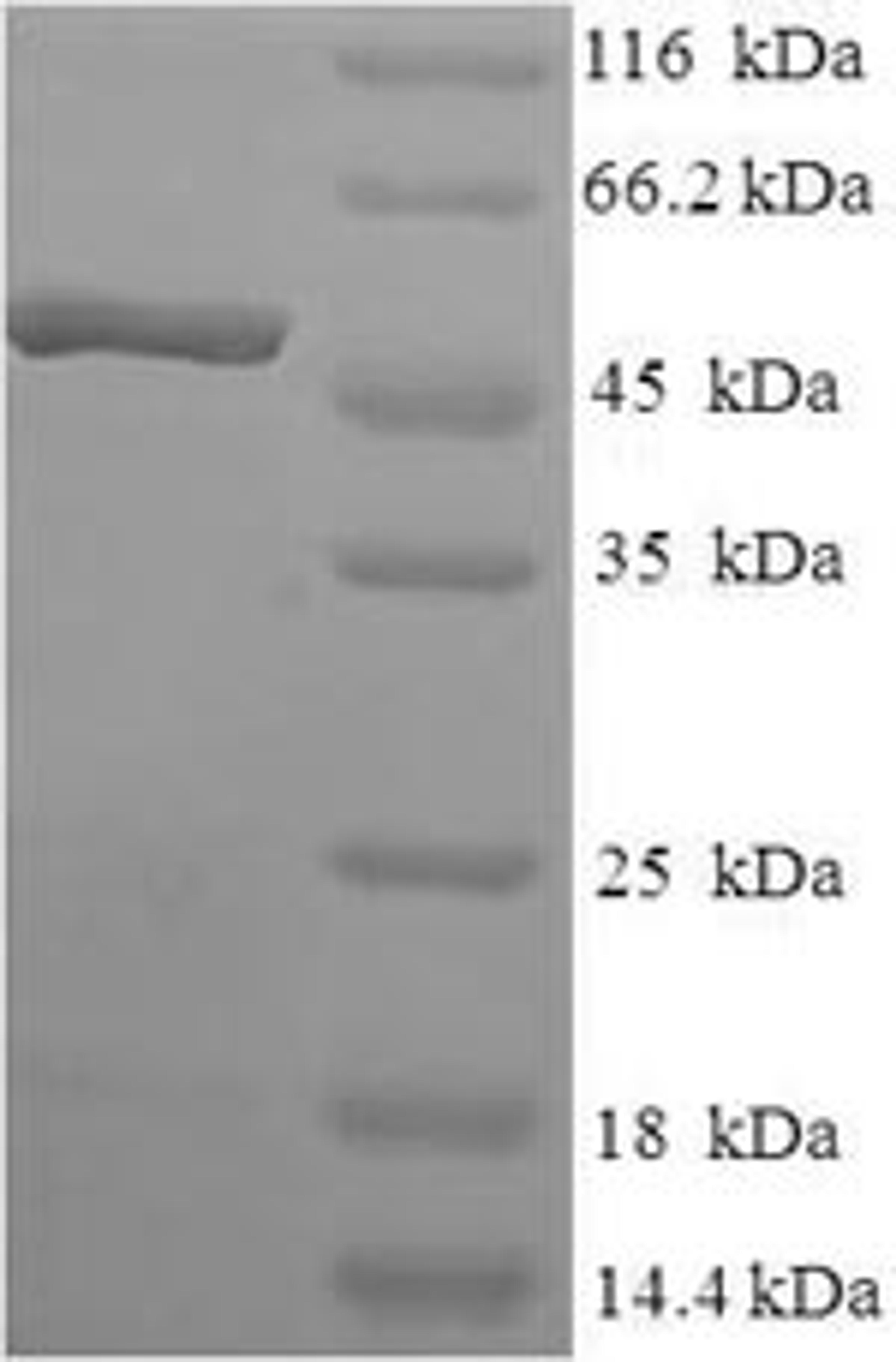 (Tris-Glycine gel) Discontinuous SDS-PAGE (reduced) with 5% enrichment gel and 15% separation gel.
