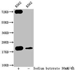 Western Blot. Detected samples: K562 whole cell lysate; Untreated (-) or treated (+) with 30mM sodium butyrate for 4h. All lanes: HIST1H1C antibody at 1:400. Secondary. Goat polyclonal to rabbit IgG at 1/50000 dilution. Predicted band size: 22 kDa. Observed band size: 22 kDa