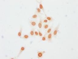 Immunocytochemistry analysis of CSB-PA010403PA23me1HU diluted at 1:15 and staining in Hela cells performed on a Leica BondTM system. The cells were fixed in 4% formaldehyde, permeabilized using 0.2% Triton X-100 and blocked with 10% normal goat serum 30min at RT. Then primary antibody (1% BSA) was incubated at 4°C overnight. The primary is detected by a biotinylated secondary antibody and visualized using an HRP conjugated SP system.