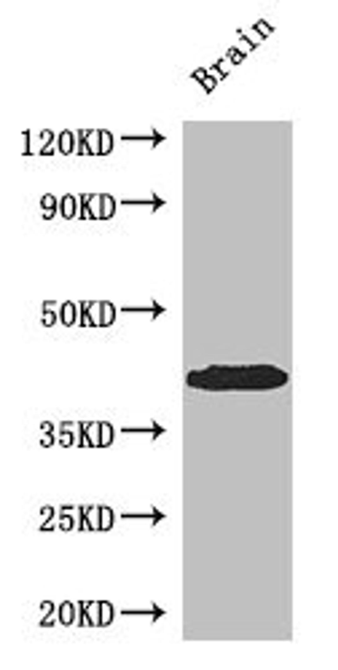 Western Blot. Positive WB detected in: Mouse brain tissue. All lanes: SPDEF antibody at 3ug/ml. Secondary. Goat polyclonal to rabbit IgG at 1/50000 dilution. Predicted band size: 38, 36 kDa. Observed band size: 38 kDa. 