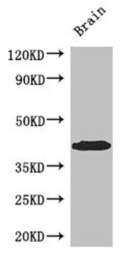 Western Blot. Positive WB detected in: Mouse brain tissue. All lanes: SPDEF antibody at 3ug/ml. Secondary. Goat polyclonal to rabbit IgG at 1/50000 dilution. Predicted band size: 38, 36 kDa. Observed band size: 38 kDa. 
