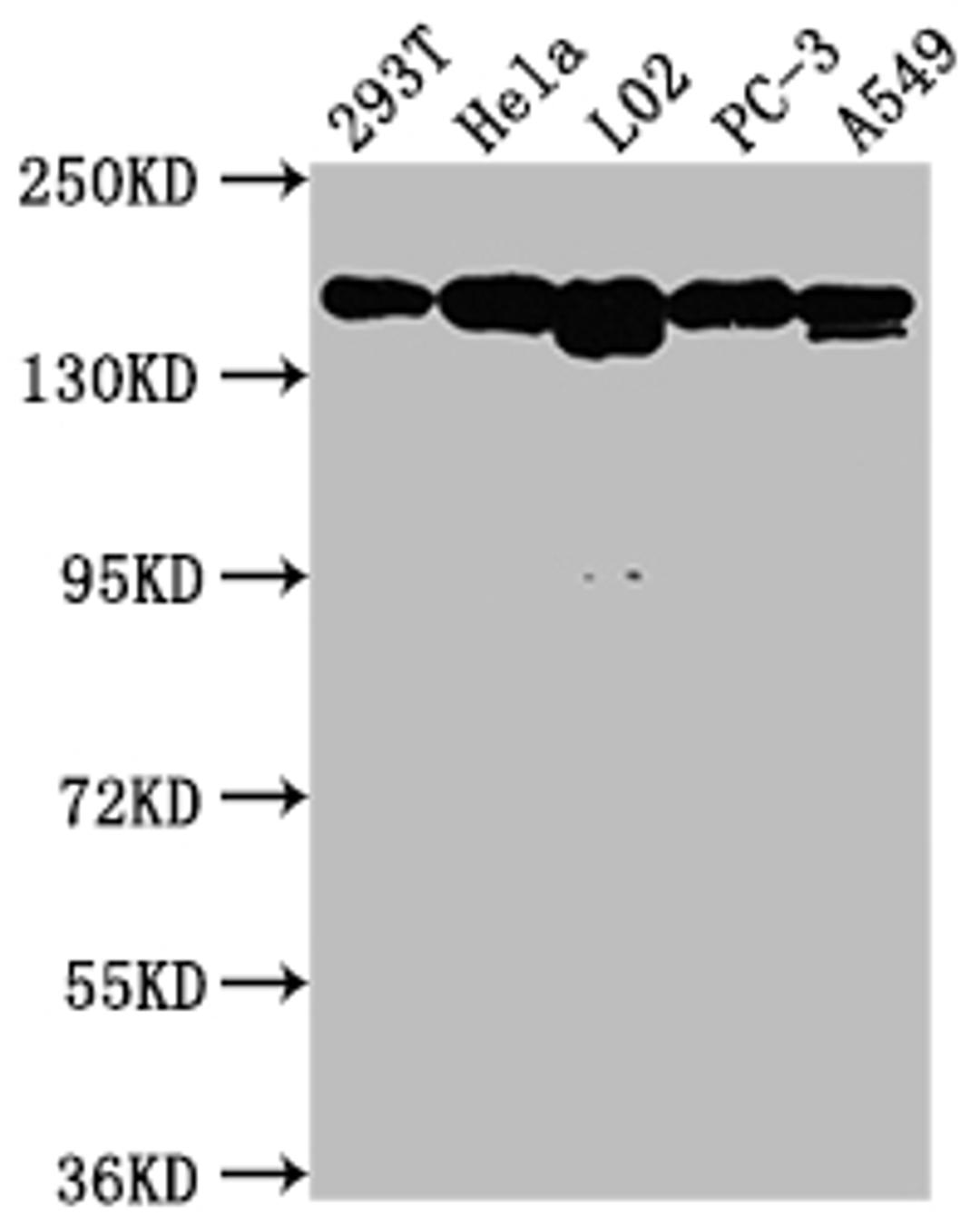 Western Blot. Positive WB detected in: 293T whole cell lysate, Hela whole cell lysate, L02 whole cell lysate, PC-3 whole cell lysate, A549 whole cell lysate. All lanes: MET antibody at 1:1500. Secondary. Goat polyclonal to rabbit IgG at 1/50000 dilution. Predicted band size: 156, 158, 86 kDa. Observed band size: 156 kDa.