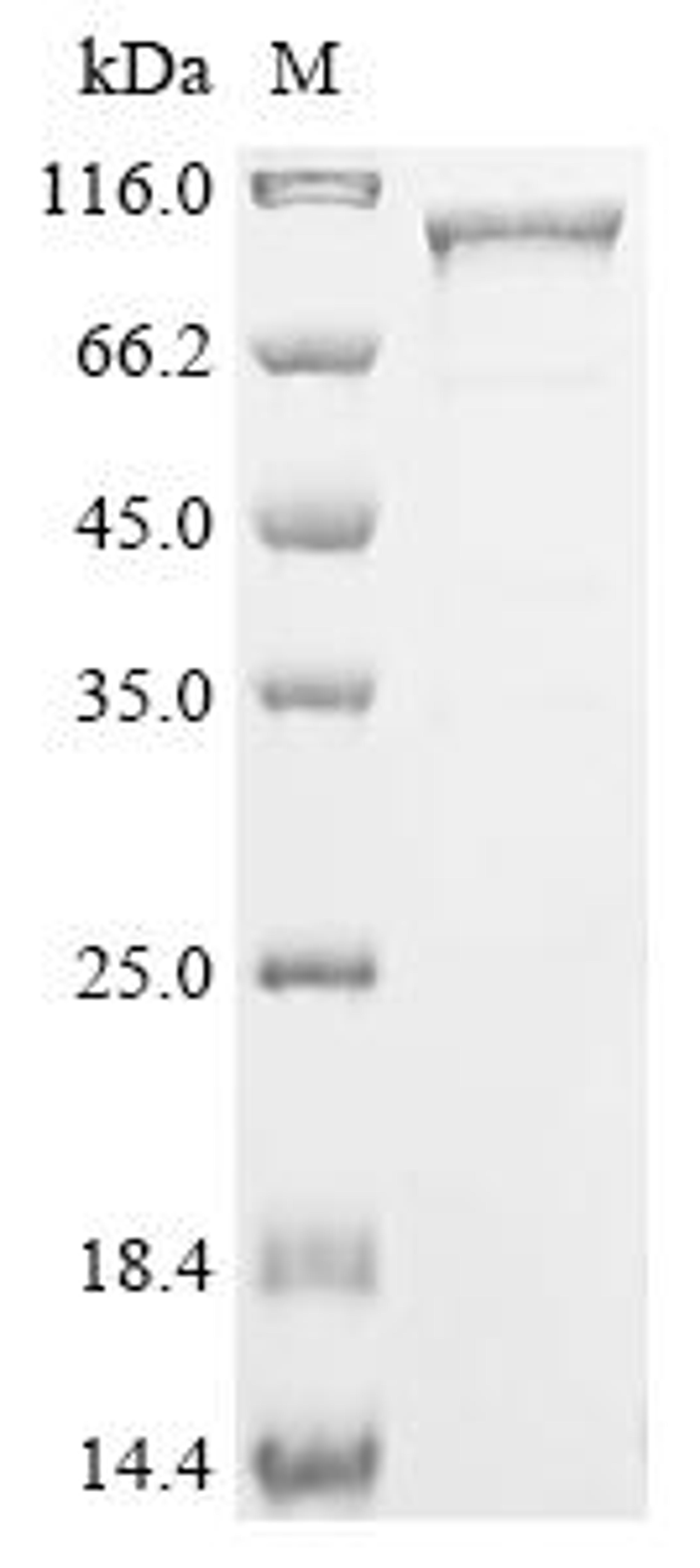 (Tris-Glycine gel) Discontinuous SDS-PAGE (reduced) with 5% enrichment gel and 15% separation gel.