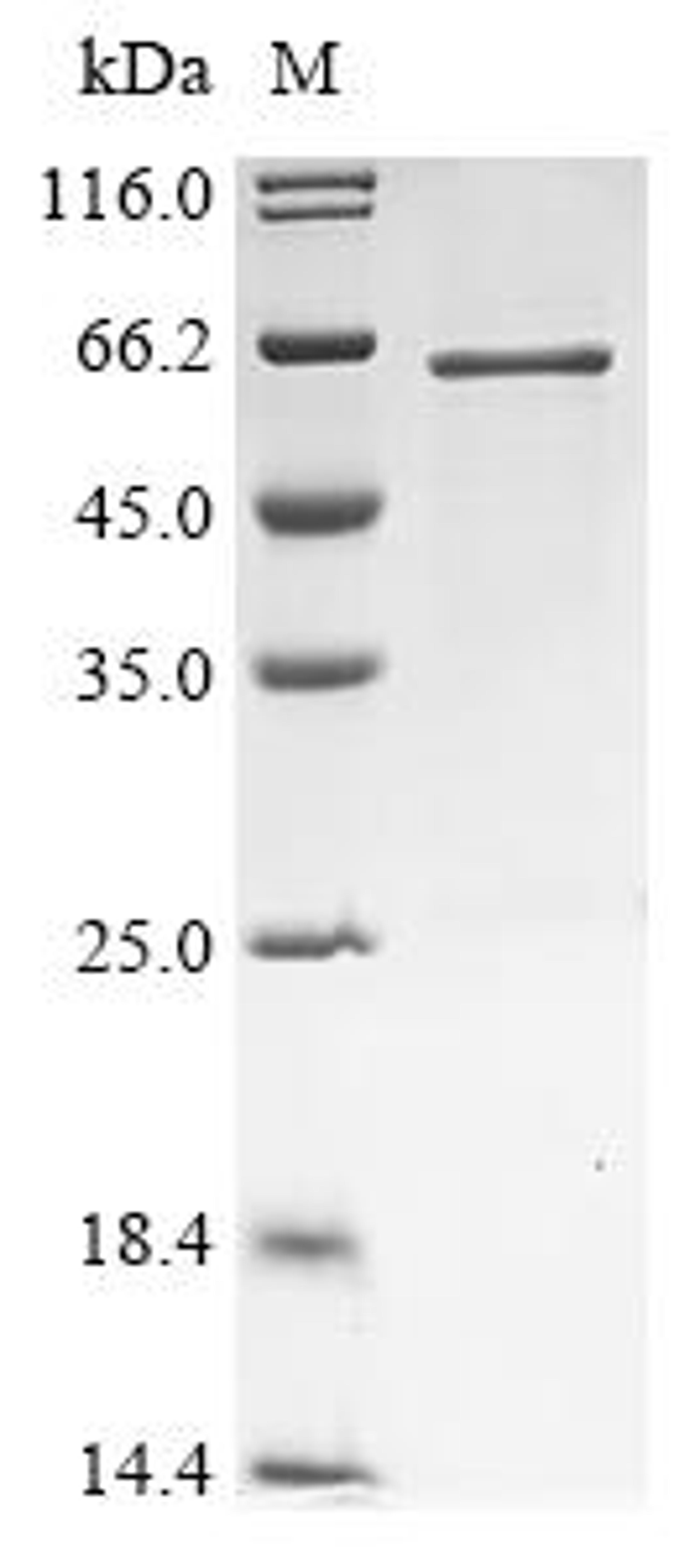 (Tris-Glycine gel) Discontinuous SDS-PAGE (reduced) with 5% enrichment gel and 15% separation gel.