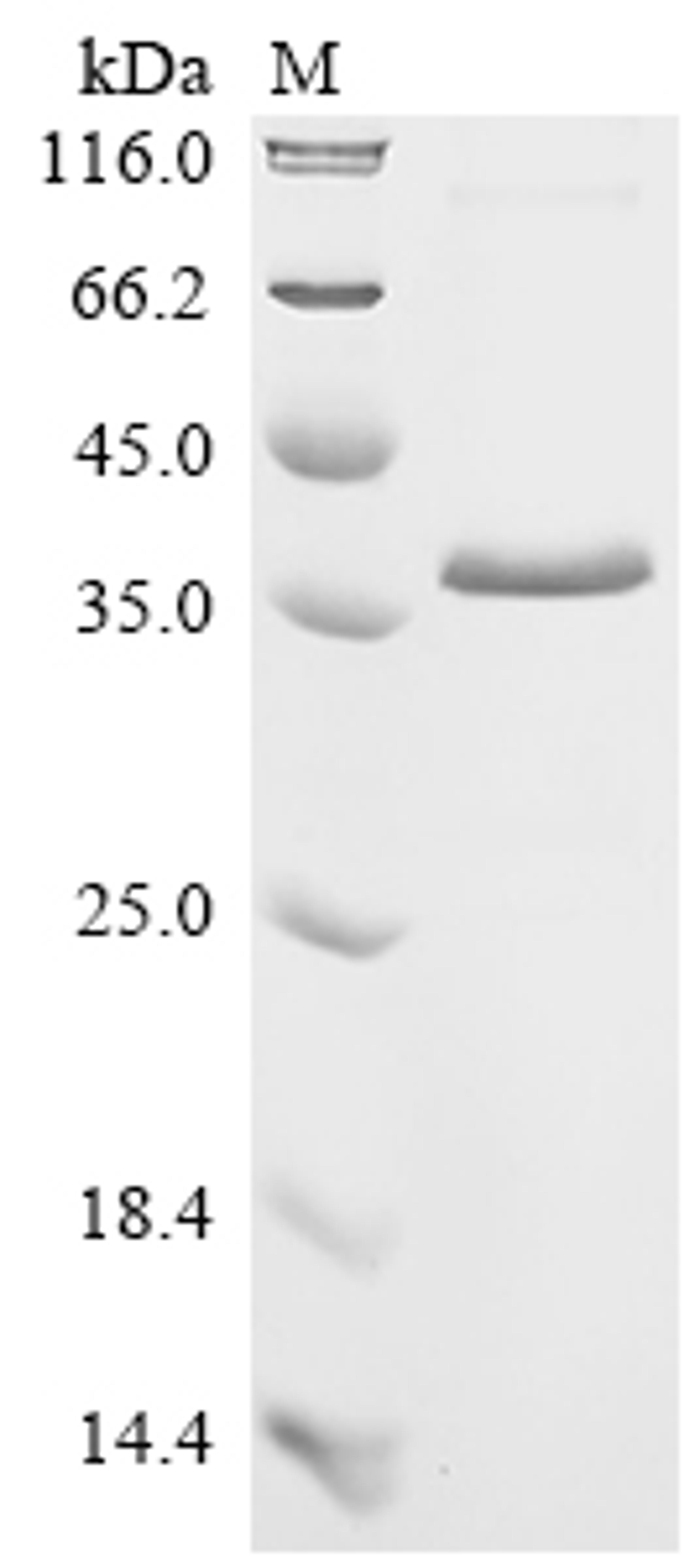 (Tris-Glycine gel) Discontinuous SDS-PAGE (reduced) with 5% enrichment gel and 15% separation gel.