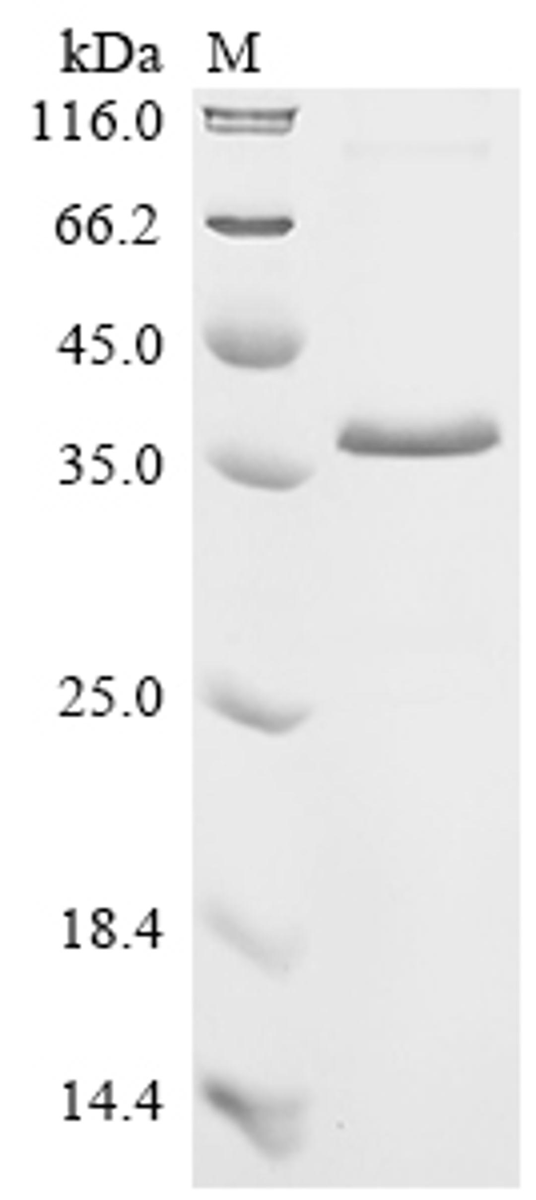 (Tris-Glycine gel) Discontinuous SDS-PAGE (reduced) with 5% enrichment gel and 15% separation gel.