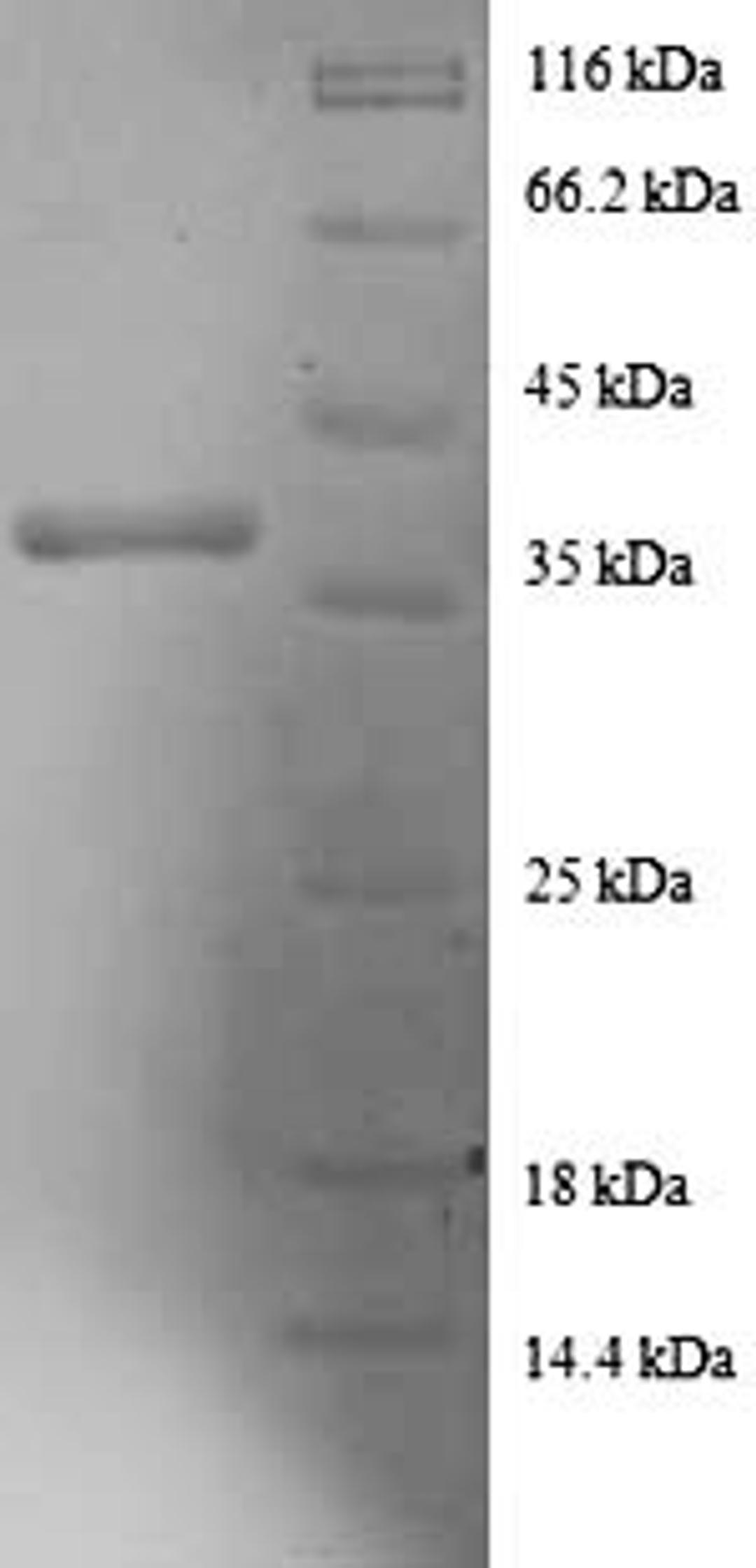 (Tris-Glycine gel) Discontinuous SDS-PAGE (reduced) with 5% enrichment gel and 15% separation gel.