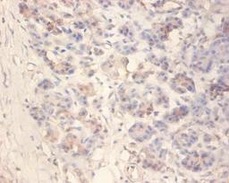 Immunohistochemistry of paraffin-embedded human pancreatic tissue using CSB-PA12224A0Rb at dilution of 1:100