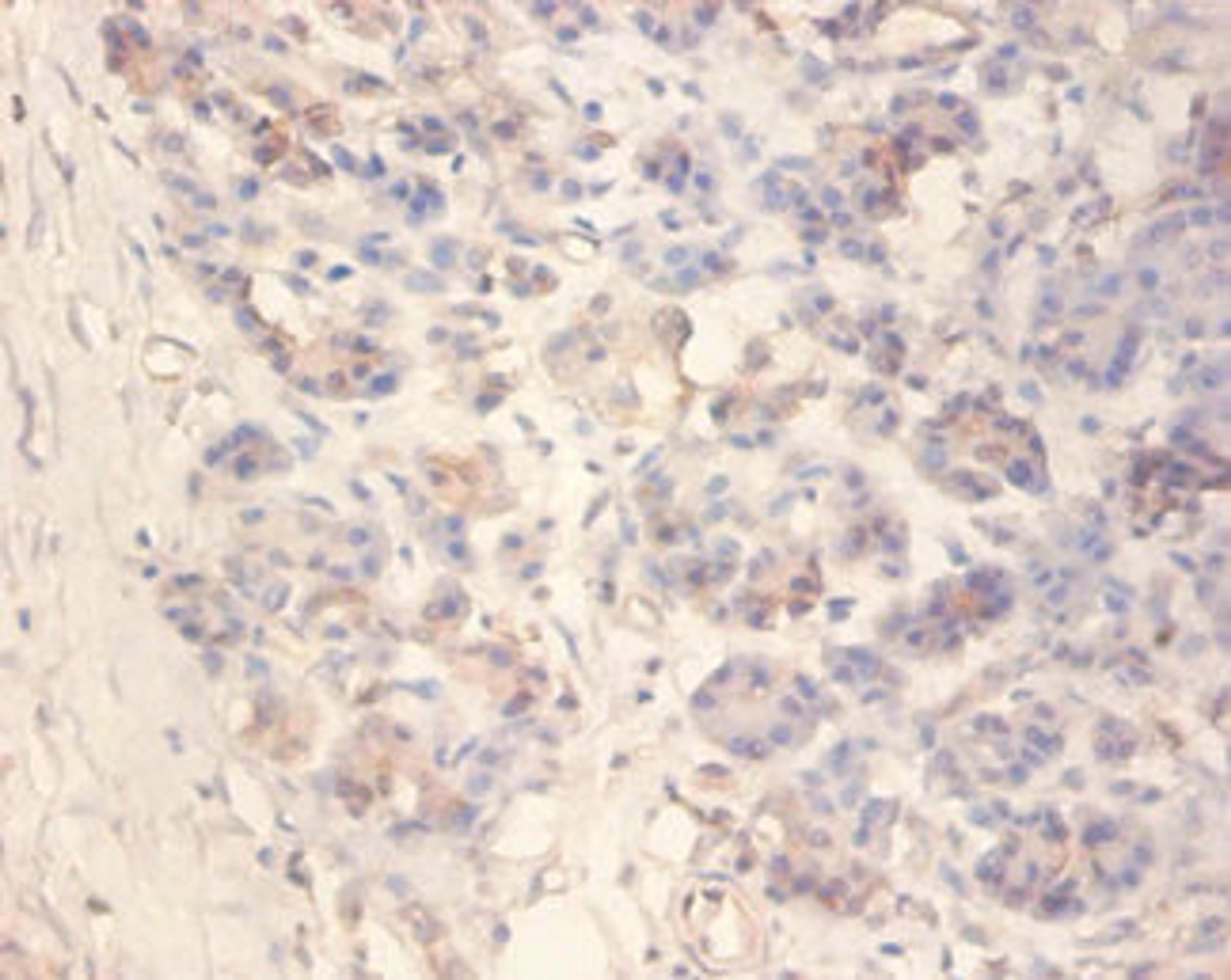 Immunohistochemistry of paraffin-embedded human pancreatic tissue using CSB-PA12224A0Rb at dilution of 1:100