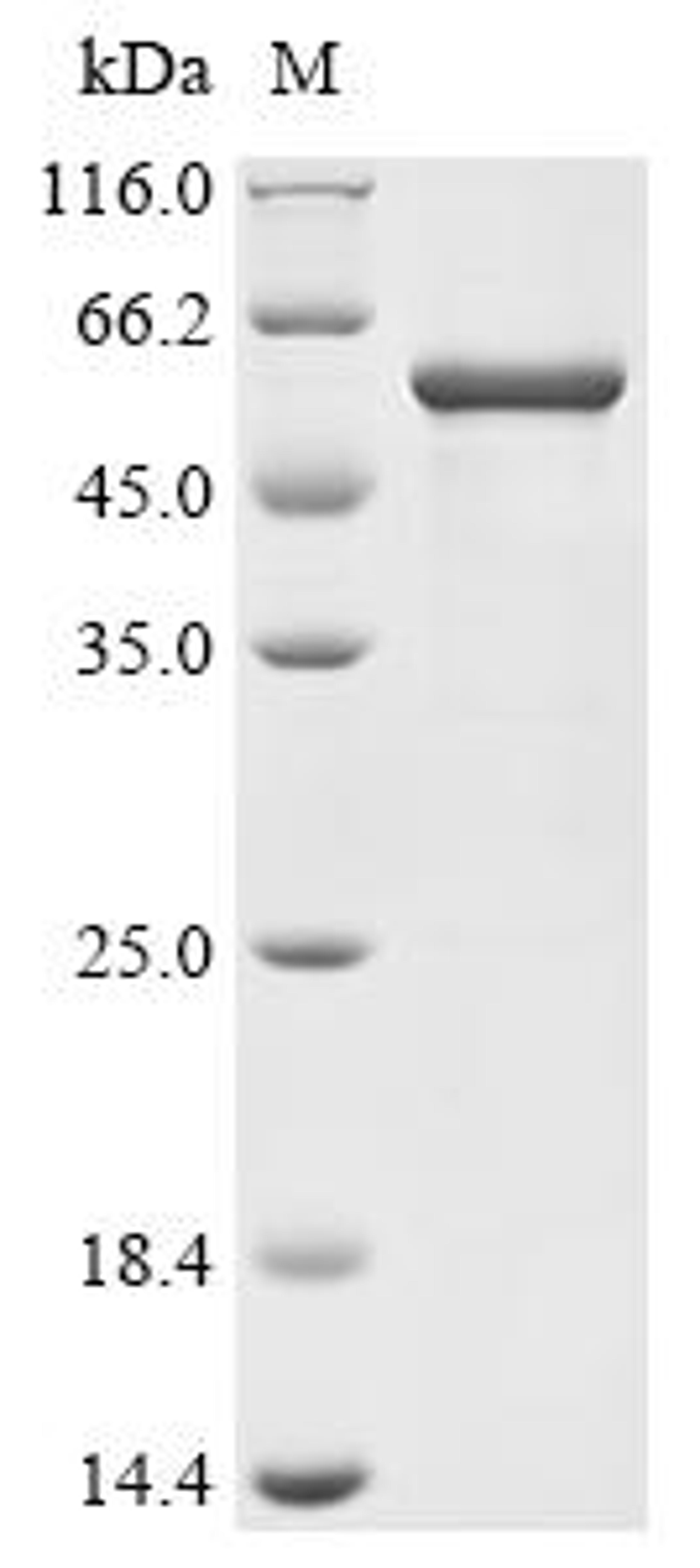 (Tris-Glycine gel) Discontinuous SDS-PAGE (reduced) with 5% enrichment gel and 15% separation gel.