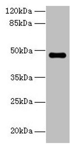 Western blot. All lanes: ZNF821 antibody at 8µg/ml + MCF-7 whole cell lysate. Secondary. Goat polyclonal to rabbit IgG at 1/10000 dilution. Predicted band size: 47, 43 kDa. Observed band size: 47 kDa